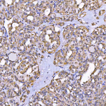 TOM1L1 Antibody