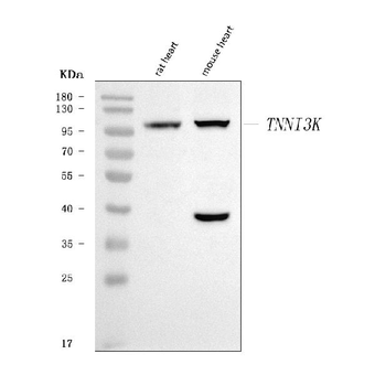 TNNI3K Rabbit Polyclonal Antibody