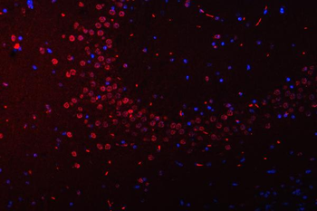 SFPQ Antibody