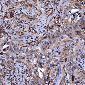 Septin 11/SEPTIN11 Antibody