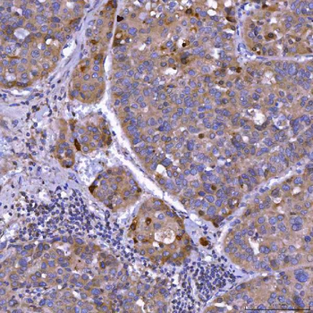 Septin 11/SEPTIN11 Antibody