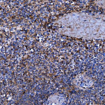 Septin 11/SEPTIN11 Antibody