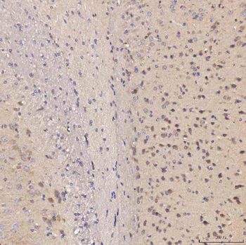 Septin 11/SEPTIN11 Antibody