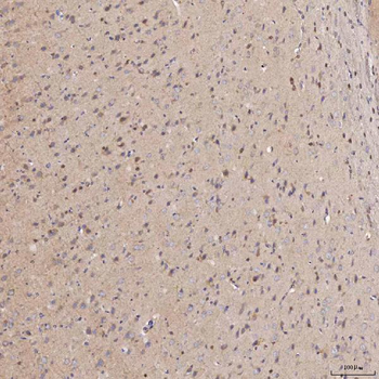 Septin 11/SEPTIN11 Antibody