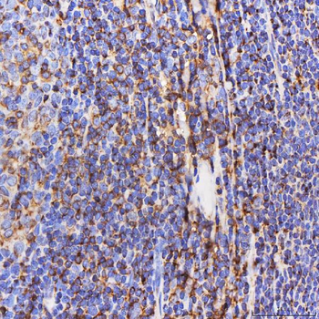 SEPT6/SEPTIN6 Antibody