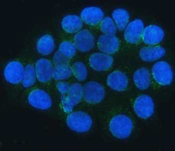 SEC24C Rabbit Polyclonal Antibody
