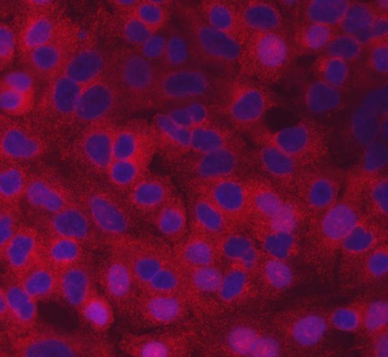 SCYL2 Rabbit Polyclonal Antibody