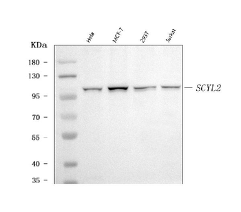 SCYL2 Rabbit Polyclonal Antibody