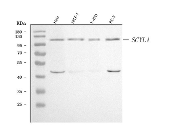 SCYL1 Rabbit Polyclonal Antibody