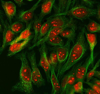 SCML1 Antibody
