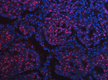 SCML1 Antibody