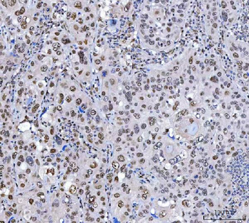 SCML1 Antibody