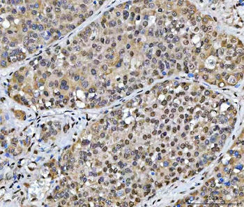 SCML1 Antibody