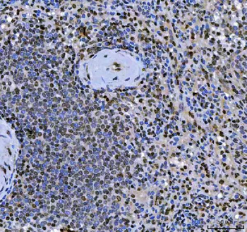 SCML1 Antibody