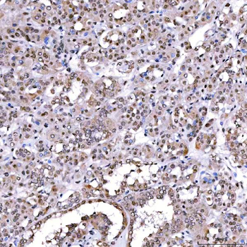SCML1 Antibody