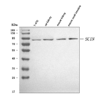 SCIN Rabbit Polyclonal Antibody