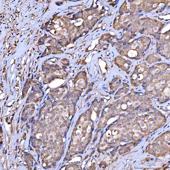Scavenging Receptor SRB2/SCARB2 Antibody