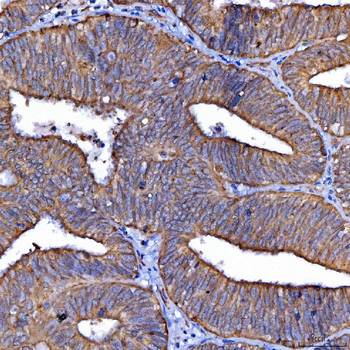 Scavenging Receptor SRB2/SCARB2 Antibody