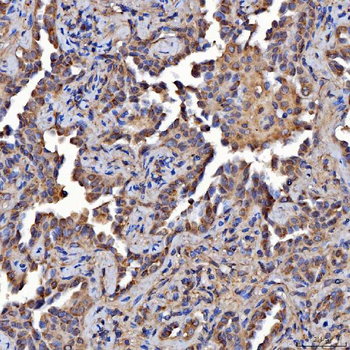 Scavenging Receptor SRB2/SCARB2 Antibody
