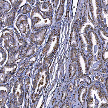 Scavenging Receptor SRB2/SCARB2 Antibody