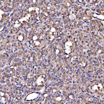Scavenging Receptor SRB2/SCARB2 Antibody