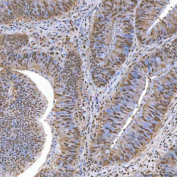 SART1 Rabbit Polyclonal Antibody