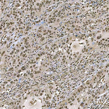 SART1 Rabbit Polyclonal Antibody