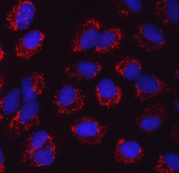 SARS2 Antibody