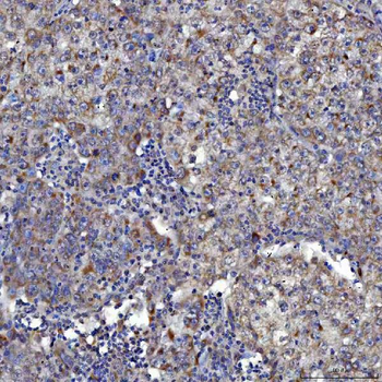 SARS2 Antibody