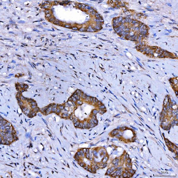 SARS2 Antibody