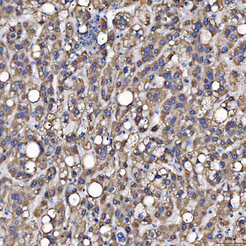 SARS2 Antibody
