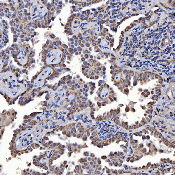 SARS2 Antibody