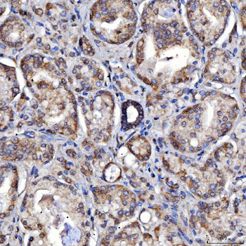 SARS2 Antibody