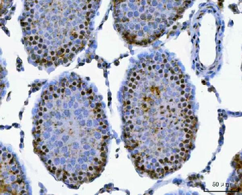 SAP130 Antibody