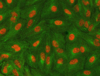 SAP130 Antibody