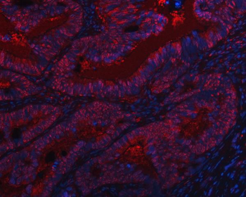 SAP130 Antibody