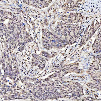 SAP130 Antibody