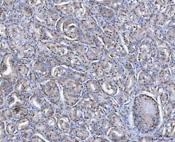 SAP130 Antibody