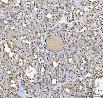 SAP130 Antibody