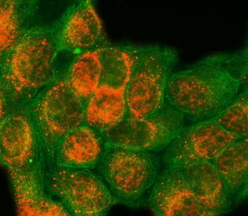 SAP18 Antibody