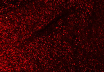 SAP18 Antibody