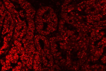 SAP18 Antibody