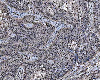 SAP18 Antibody