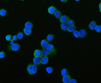 SAMSN1 Rabbit Polyclonal Antibody