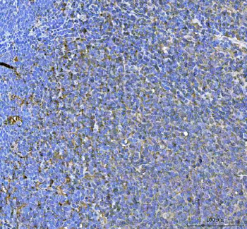 SAMSN1 Rabbit Polyclonal Antibody