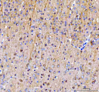 SAMSN1 Rabbit Polyclonal Antibody