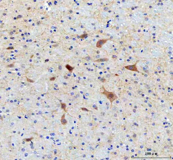 SAMSN1 Rabbit Polyclonal Antibody