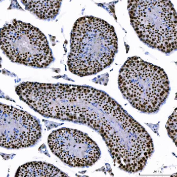 SAE1 Antibody