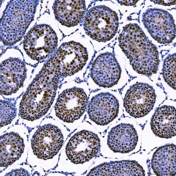 SAE1 Antibody