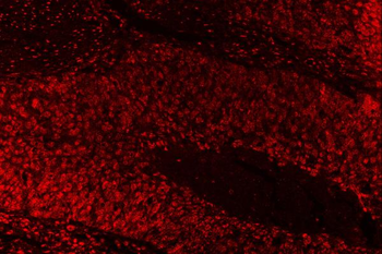 SAE1 Antibody